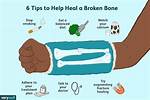 Mend as a Broken Bone
