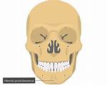 Mental Protuberance
