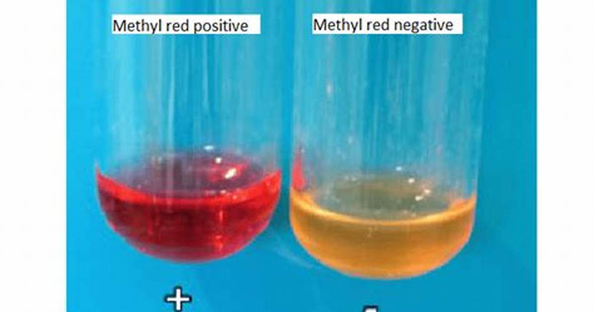 Methyl Red Test