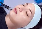 Microderm Infusion