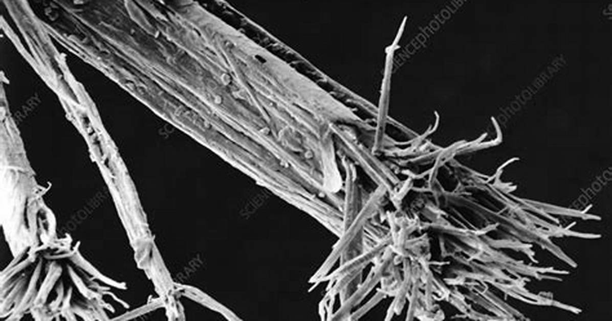 Microscope Split Ends
