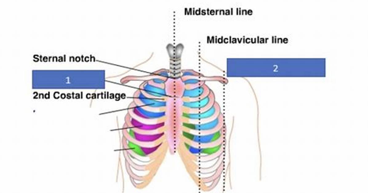 Midclavicular