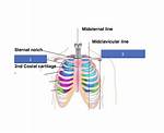 Midclavicular