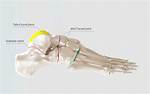 Midtarsal Joint