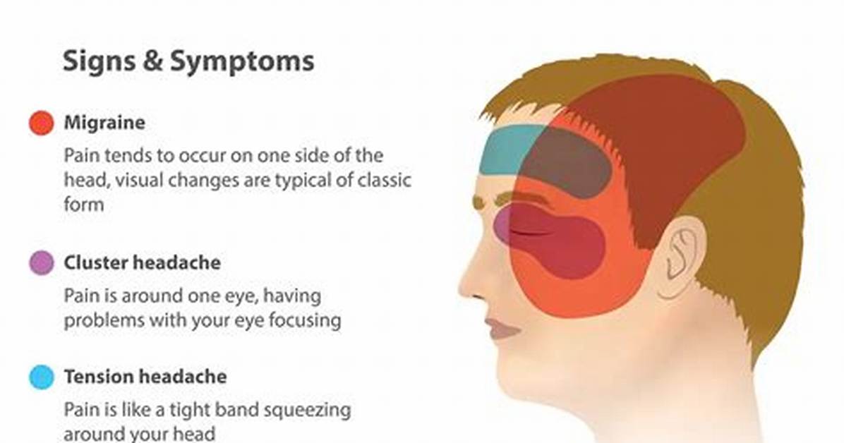 Migraine for Example