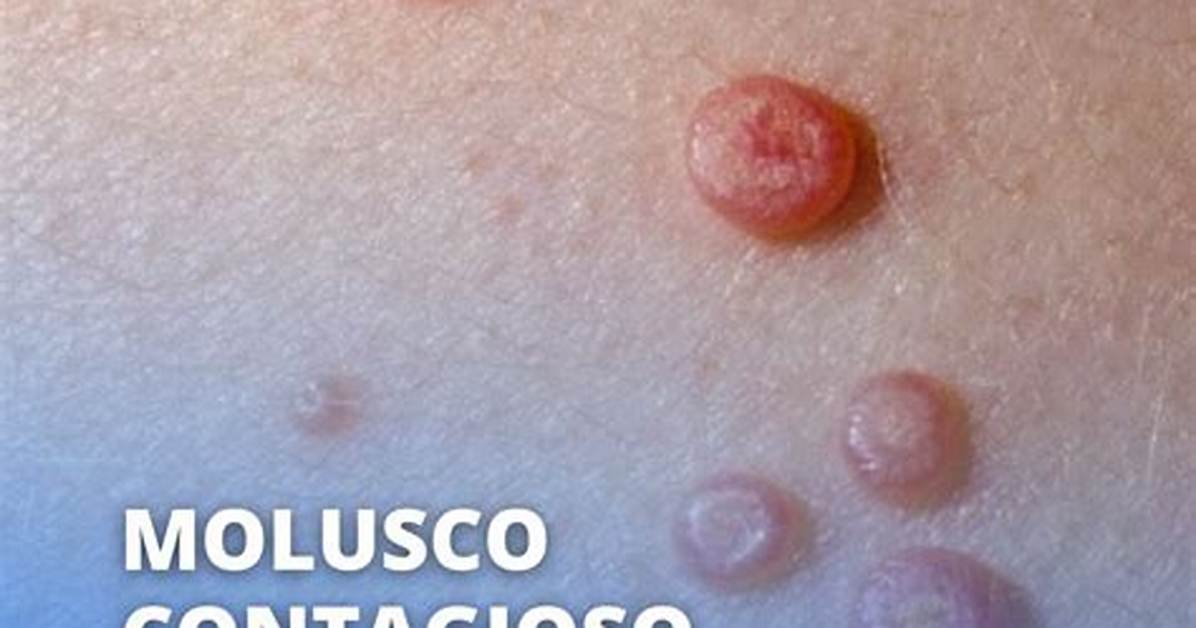 Molusco