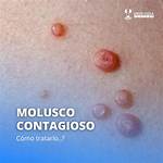 Molusco