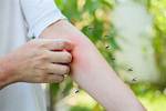Mosquito's Attack