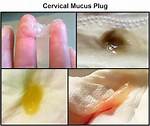 Mucus Plug Falling Out