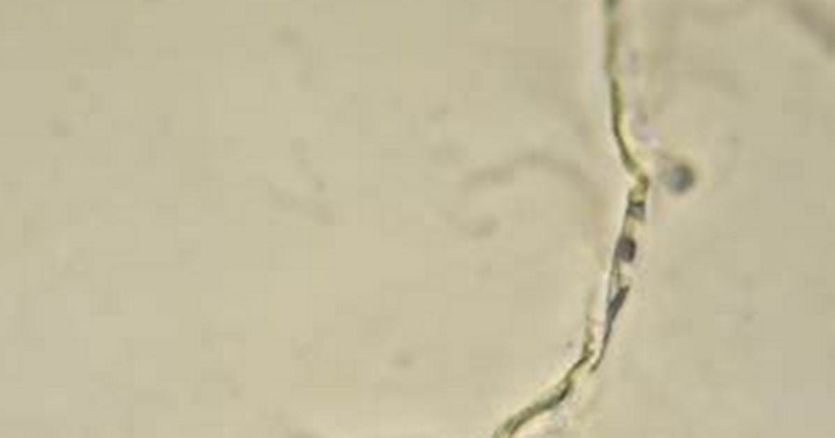 Mucus Threads