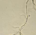 Mucus Threads