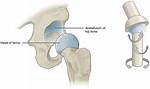 Multiaxial Joint