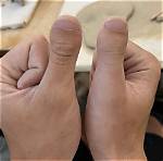 Murderer’s Thumb