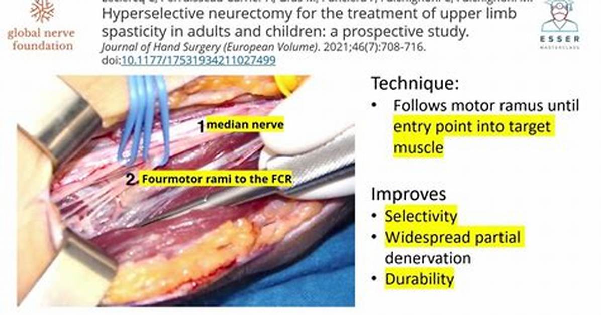 Neurectomy