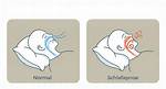 Neurosleep