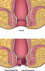 Normal Anus