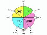 Normal Axis Ecg