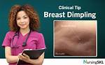 Normal Breast Dimpling