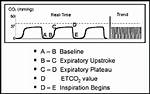 Normal Etco2 Levels