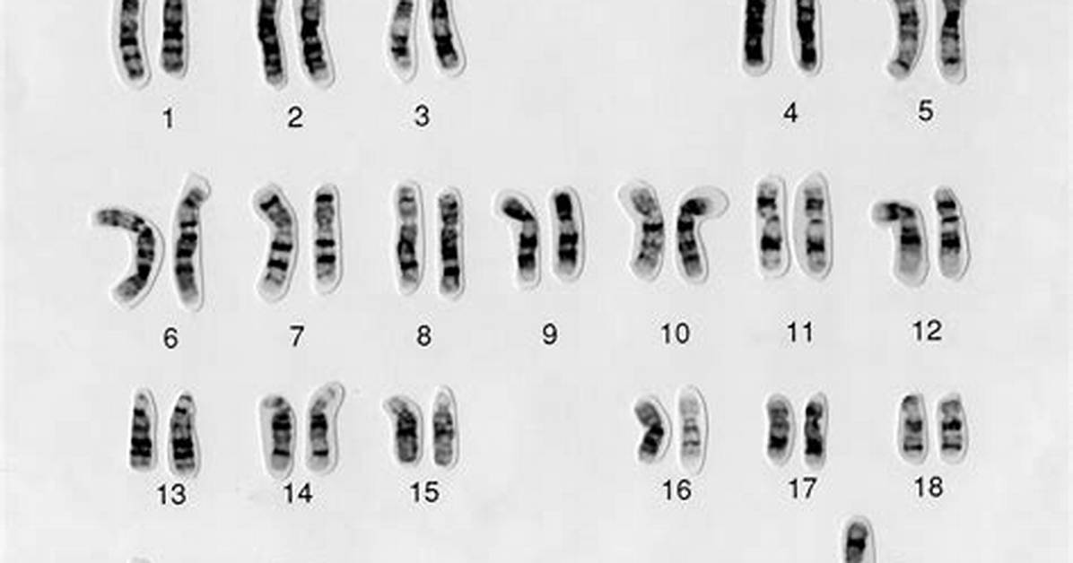 Normal Karyotype