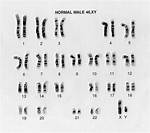 Normal Karyotype