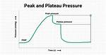 Normal Plateau Pressure