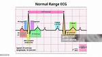 Normal Pr Interval Range