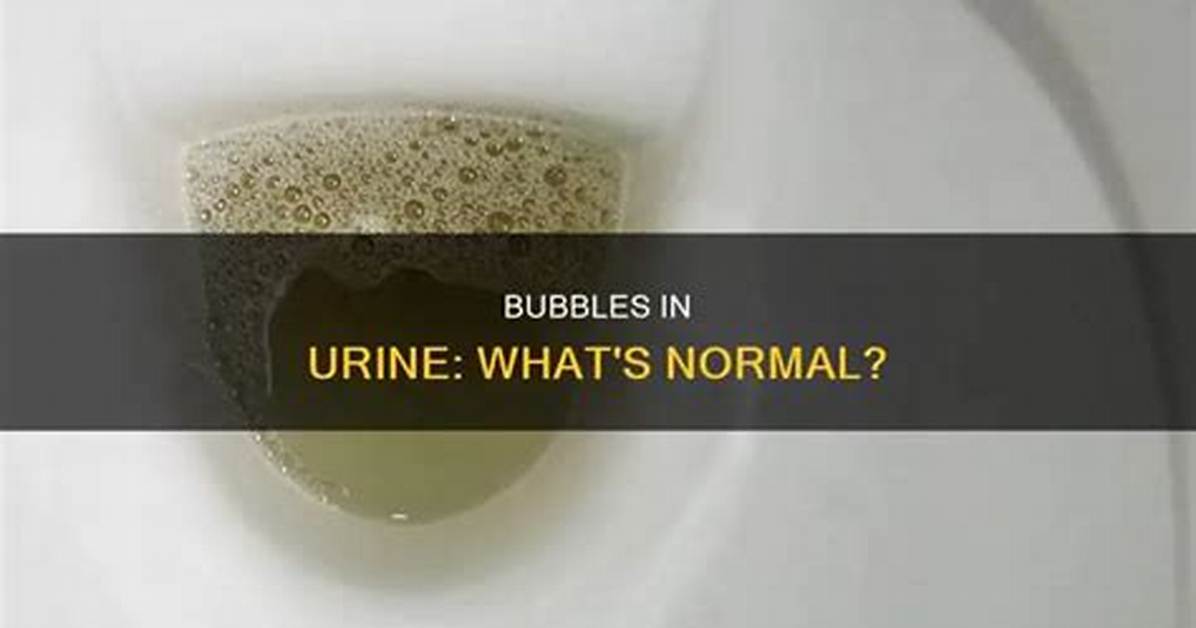 Normal Urine Bubbles
