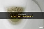 Normal Urine Bubbles
