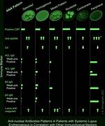 Nucleolar Ana Pattern