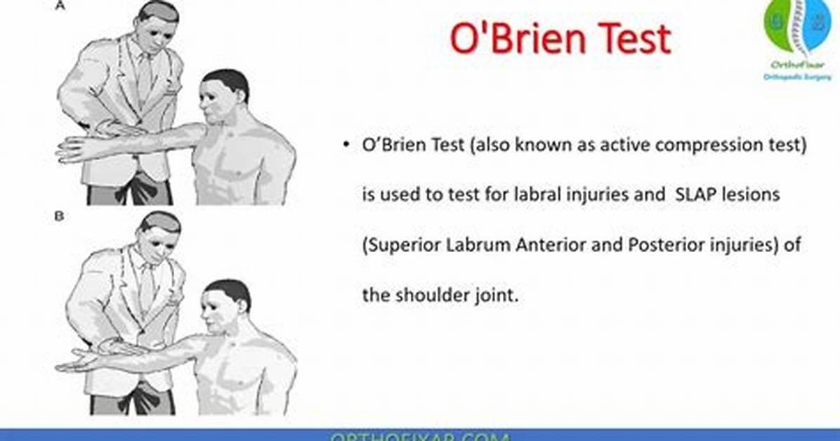 O’brien Test