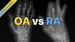 Oa Explained