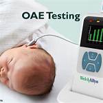 Oae Test