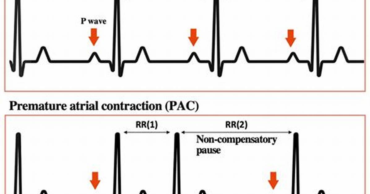 Pac Rhythm
