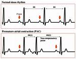 Pac Rhythm
