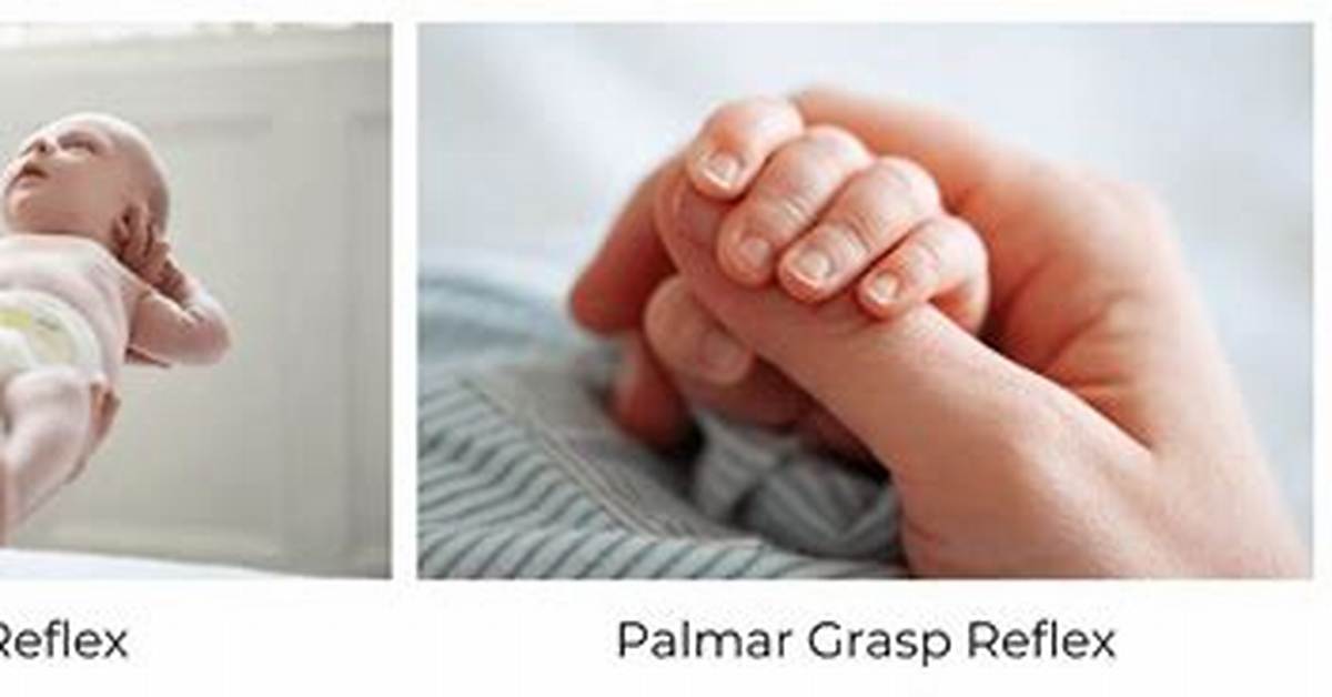 Palmar Reflex