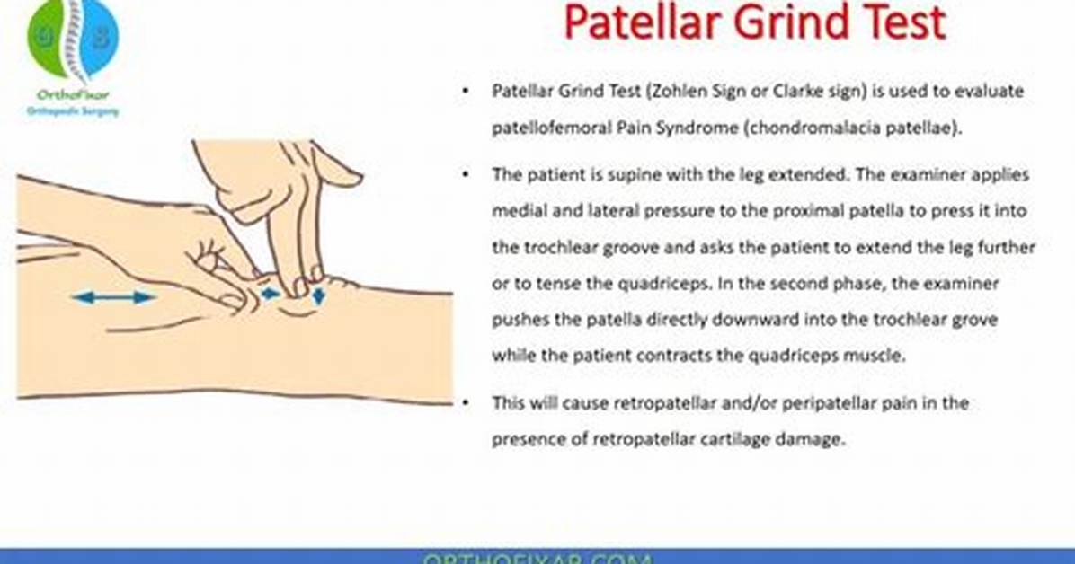 Patellar Grind Test