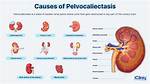 Pelvicaliectasis