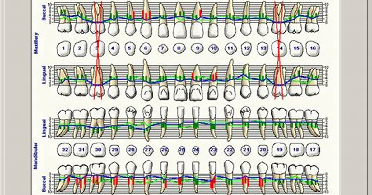 Perio Charting