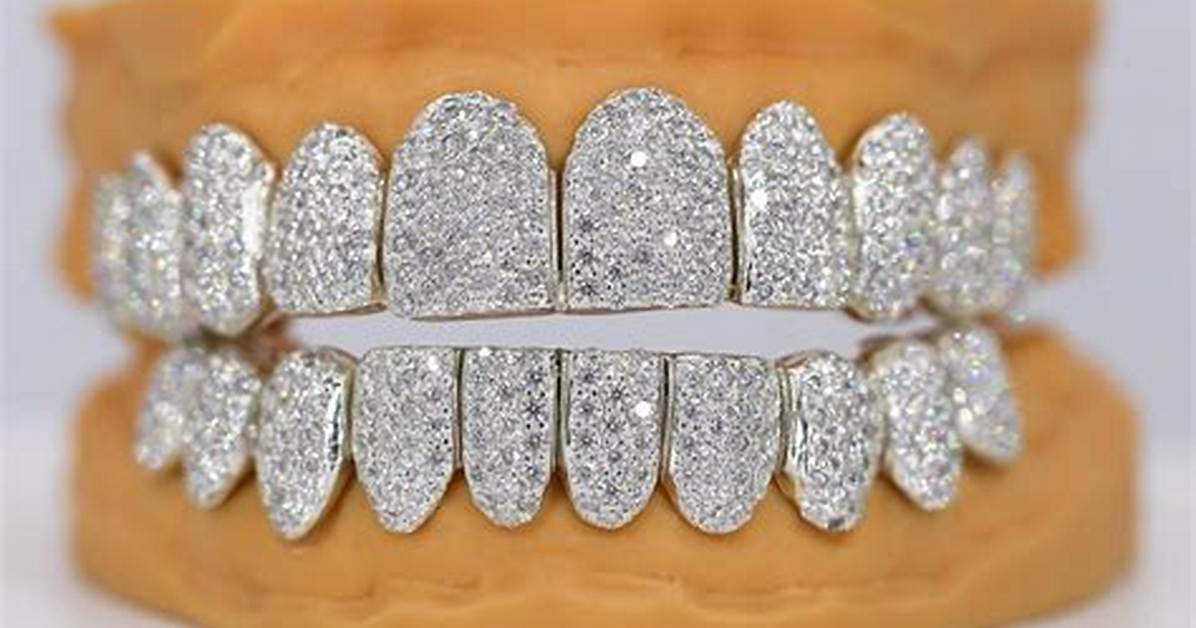 Permanent Grillz