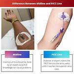 Picc vs Midline