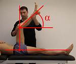 Popliteal Angle
