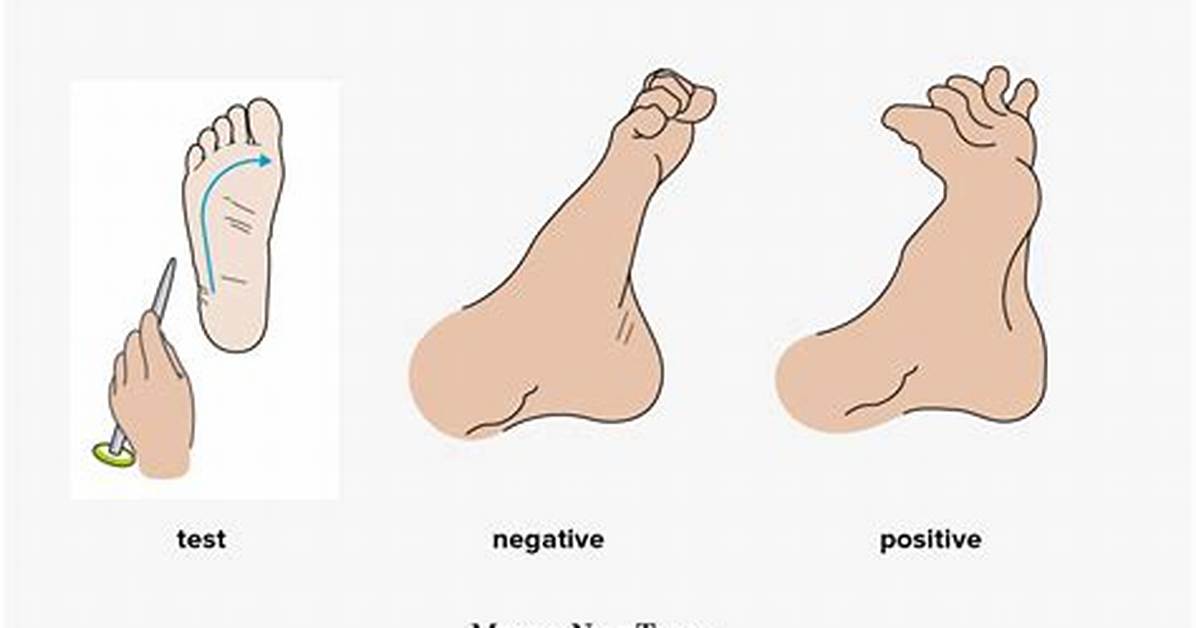 Positive Babinski Test
