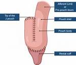 Pouchoscopy