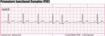 Premature Junctional Complex