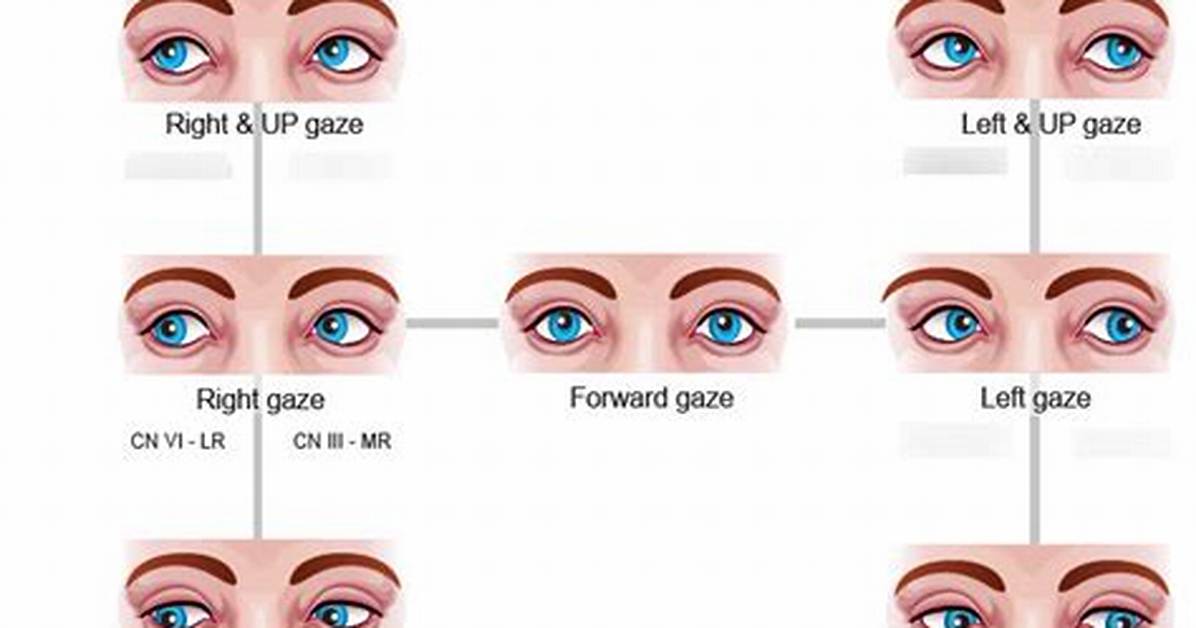 Prolonged Gaze