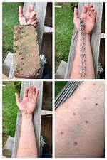 Prong Collar Damage