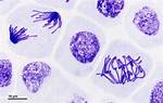 Prophase Under Microscope
