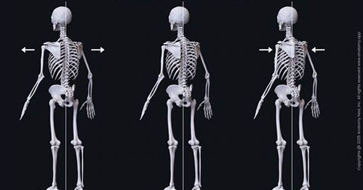 Protraction Movement