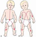Proximodistal Development